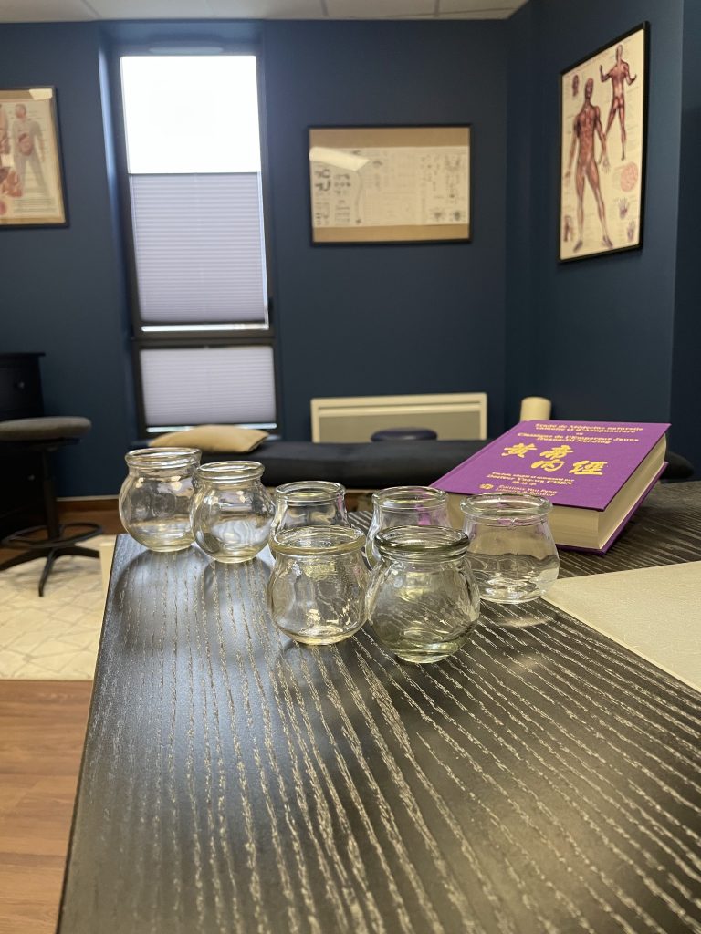 ostéopathe la roche sur yon, cervicalgies, douleur cerviclae, torticoli, mtc, médecine chinoise, ventouses